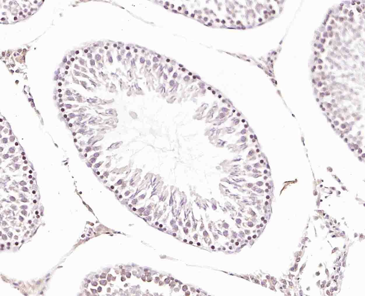 Anti-GRP75 Polyclonal Antibody