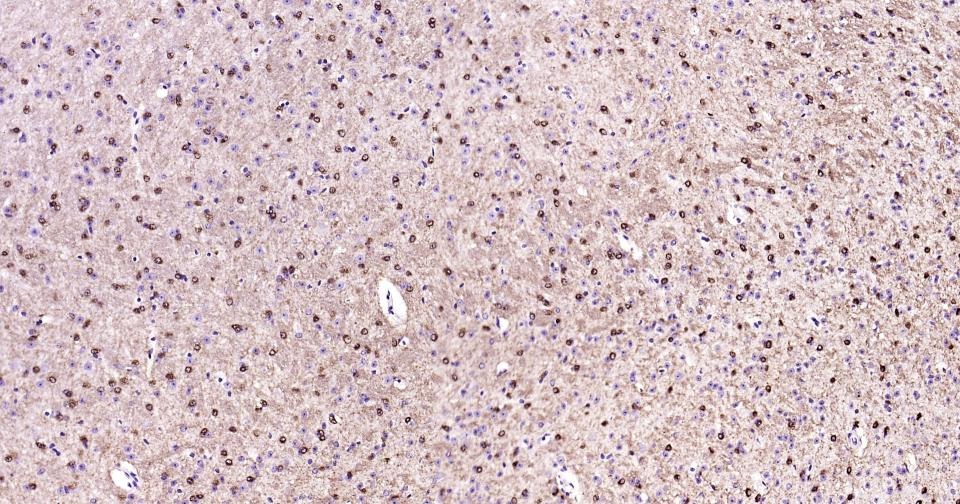 Anti-GRIN1 Antibody (5R681)