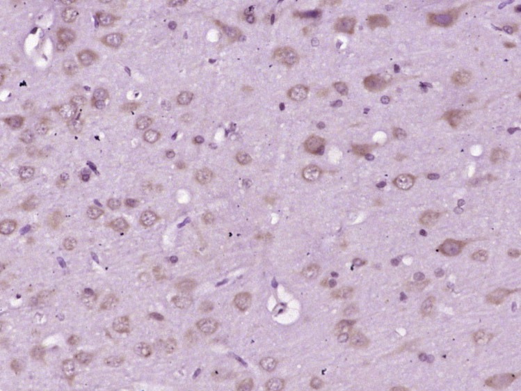 Anti-HSPA5 Polyclonal Antibody