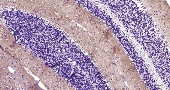 Anti-GRIA1 Polyclonal Antibody