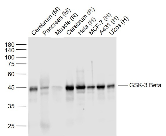 Anti-GSK3B Antibody (5W152)