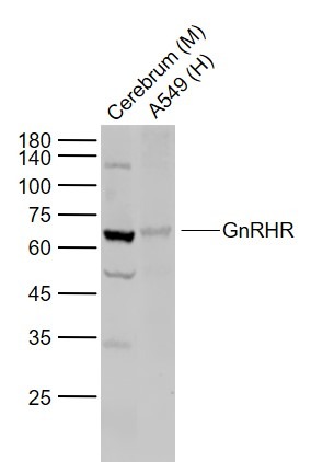 Anti-GnRHR Polyclonal Antibody