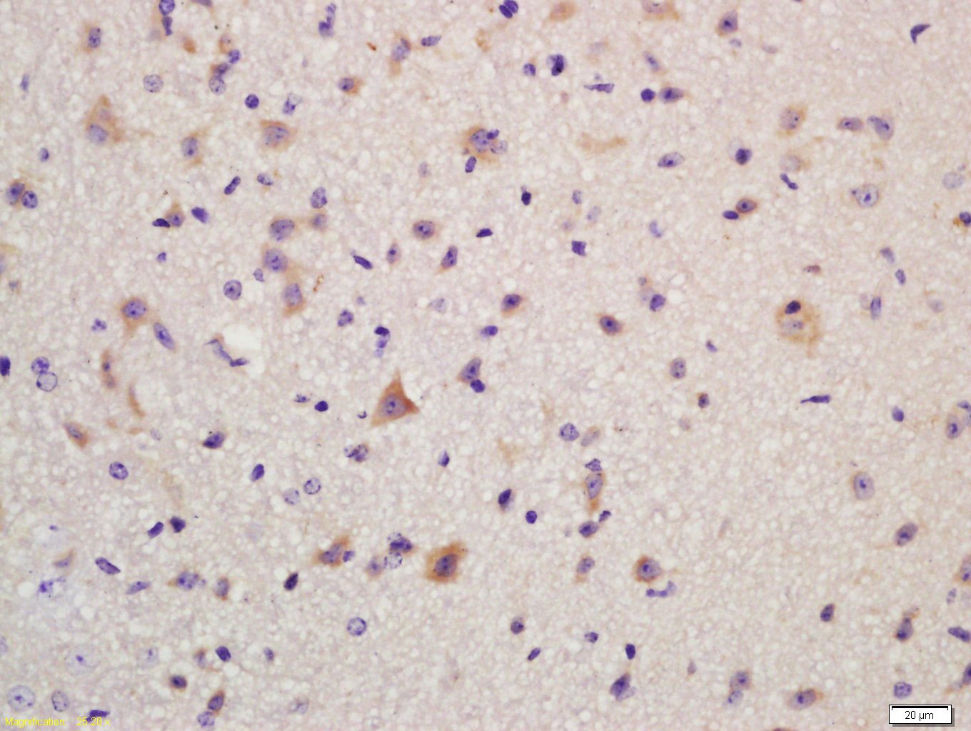 Anti-GRIA2 Polyclonal Antibody