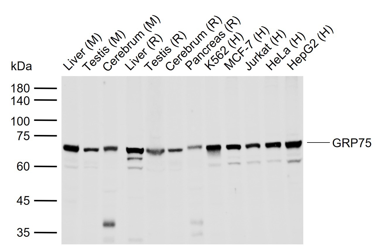 Anti-GRP75 Polyclonal Antibody