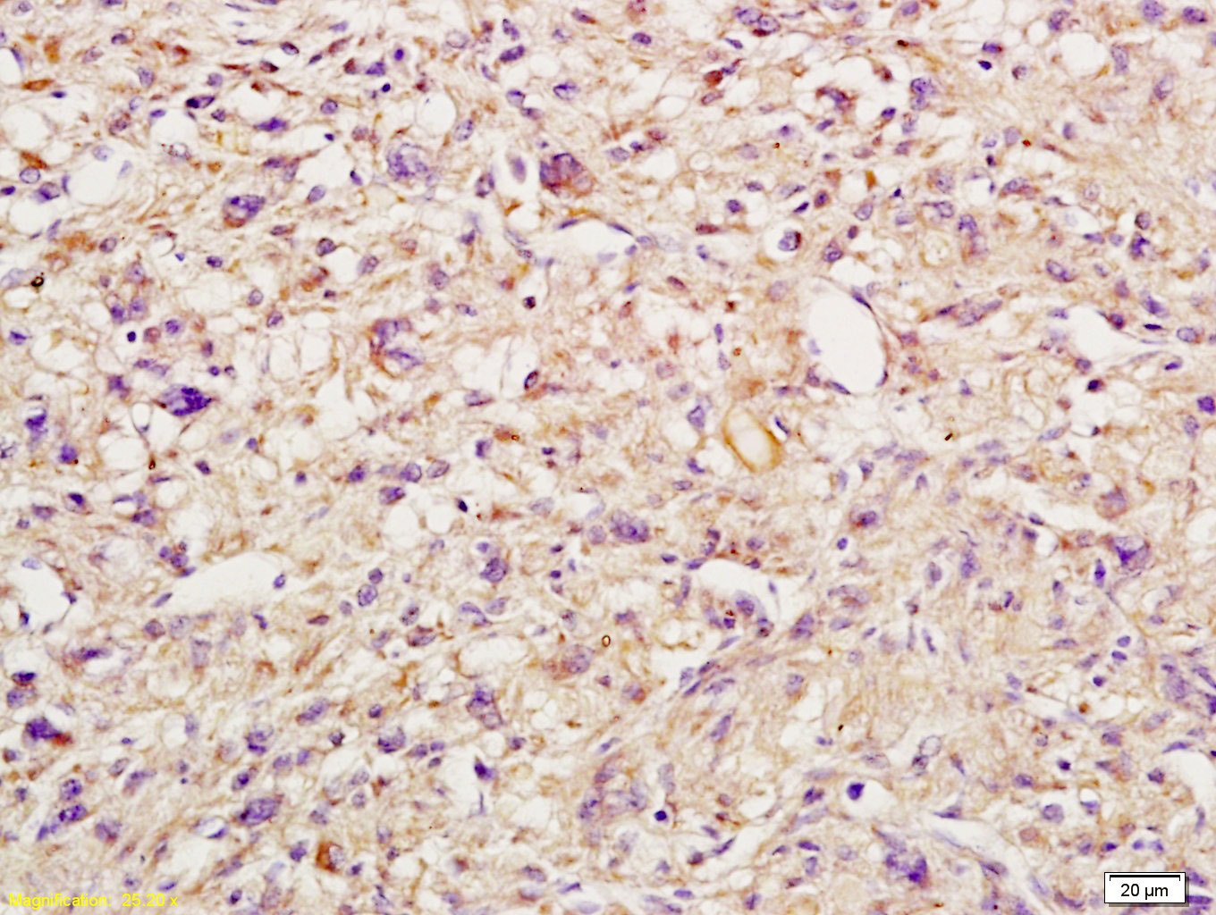 Anti-gp130/IL6ST Polyclonal Antibody