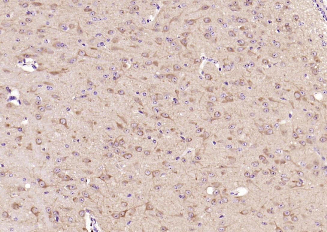 Anti-GSK3B Polyclonal Antibody