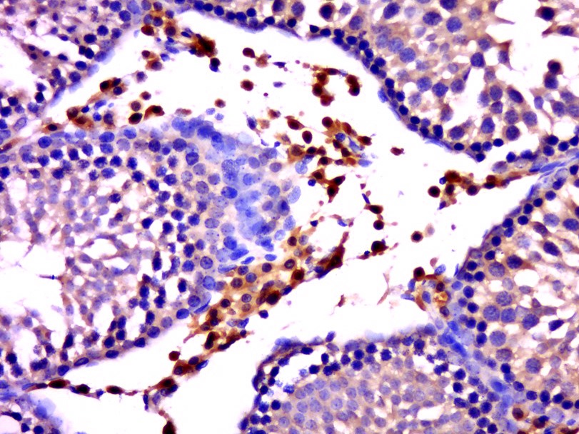 Anti-GNAT3 Polyclonal Antibody