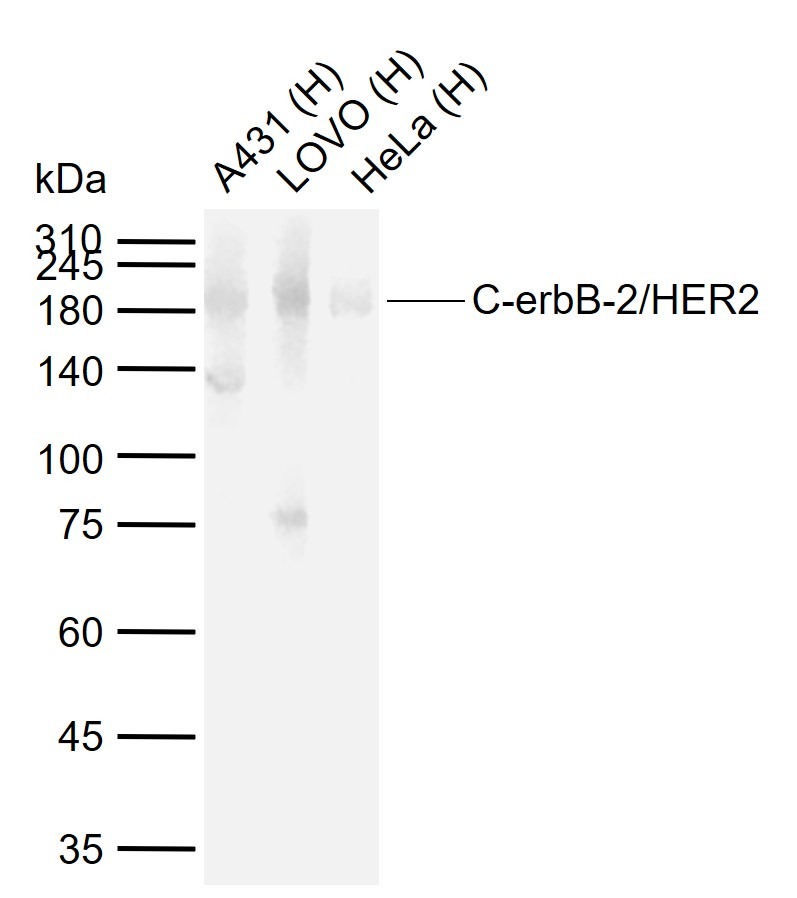 Anti-HER2/ERBB2 Antibody (3F246)