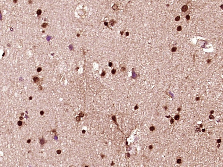 Anti-HES1 Polyclonal Antibody