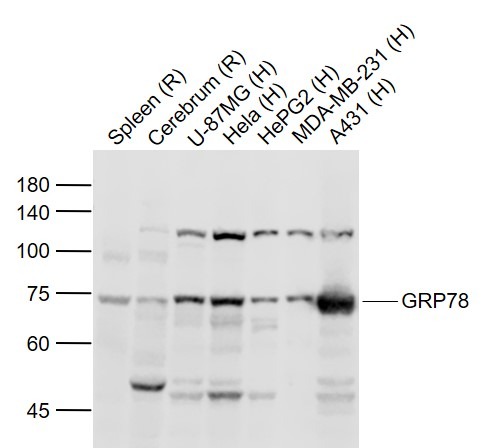 Anti-HSPA5 Polyclonal Antibody