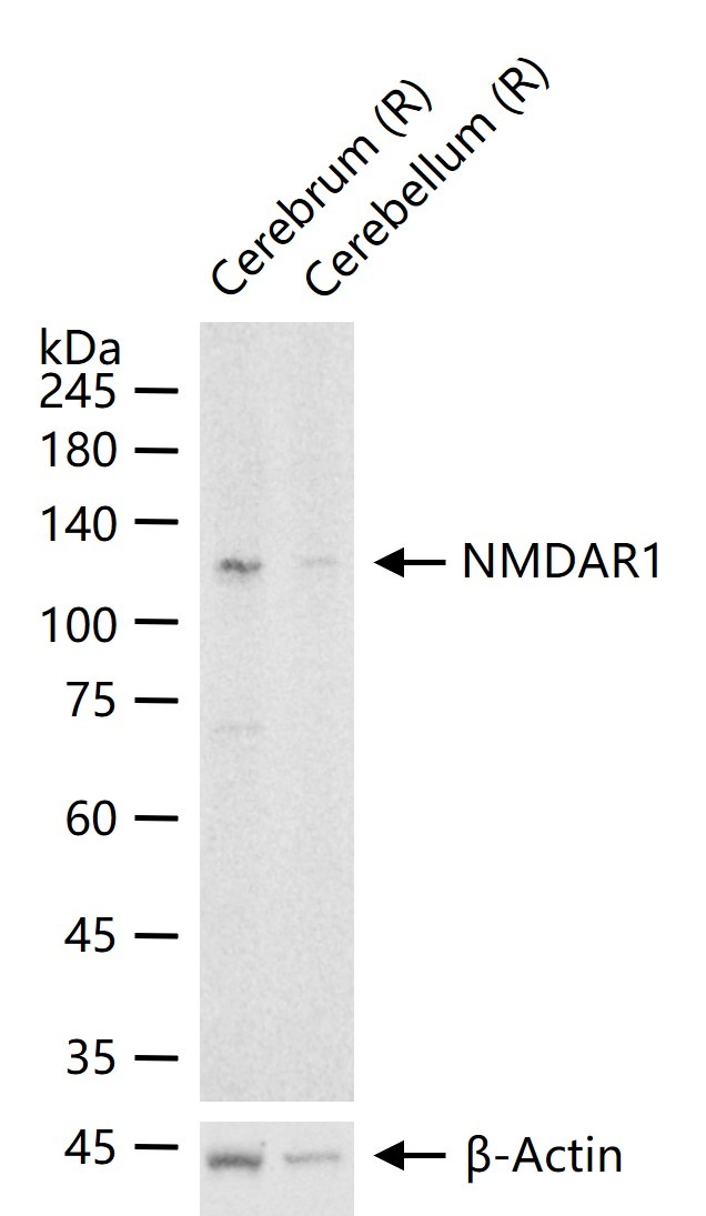 Anti-GRIN1 Antibody (5R681)