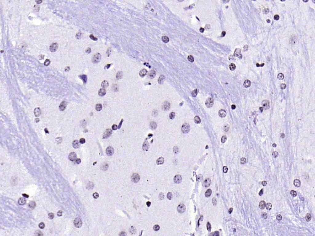 Anti-HFH4 Polyclonal Antibody