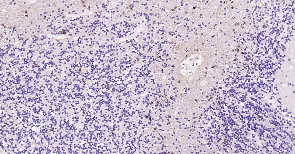 Anti-GRIN1 Antibody (5R681)