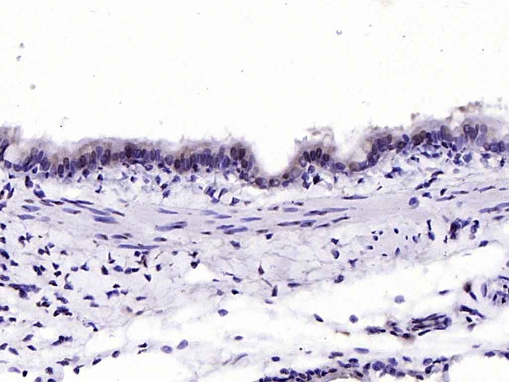 Anti-HFH4 Polyclonal Antibody