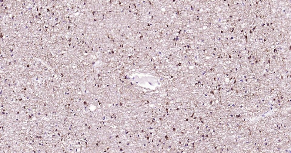 Anti-GRIN1 Antibody (5R681)