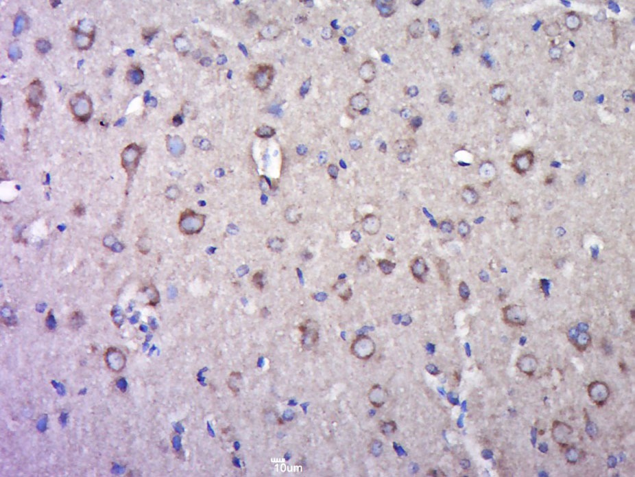 Anti-GRIA2 Polyclonal Antibody