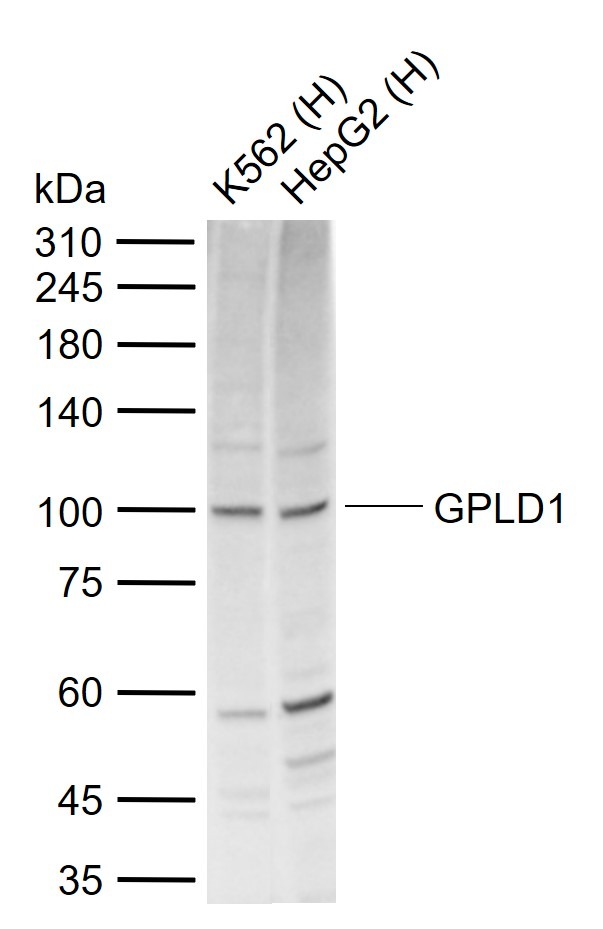 Anti-GPLD1 Polyclonal Antibody