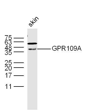 Anti-GPR109A Polyclonal Antibody