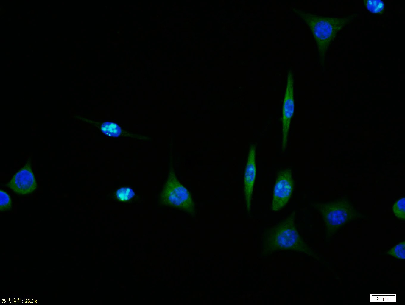 Anti-GPR30 Polyclonal Antibody 2