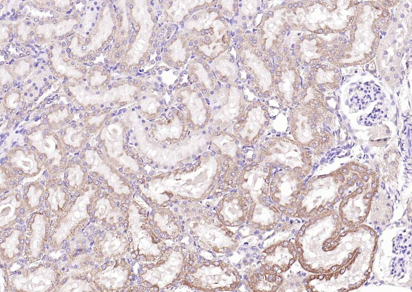 Anti-GPLD1 Polyclonal Antibody