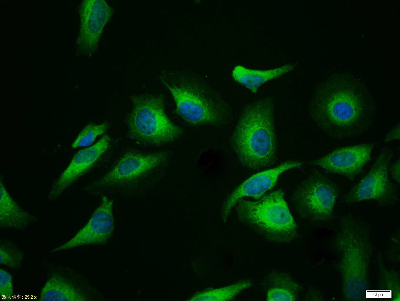 Anti-GSK3B Polyclonal Antibody 3