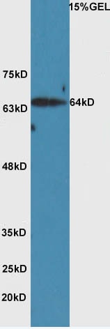 Anti-HAS2 Polyclonal Antibody