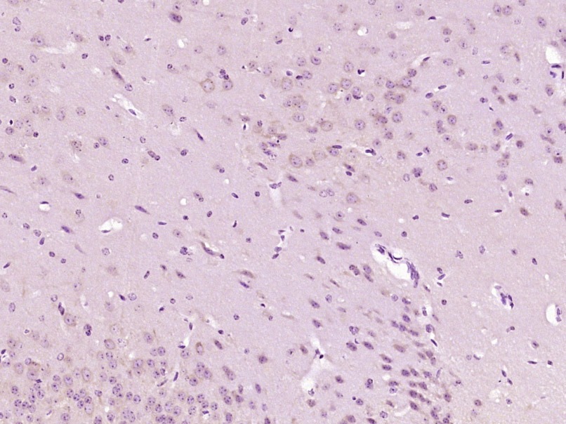 Anti-GTP cyclohydrolase 1 Polyclonal Antibody