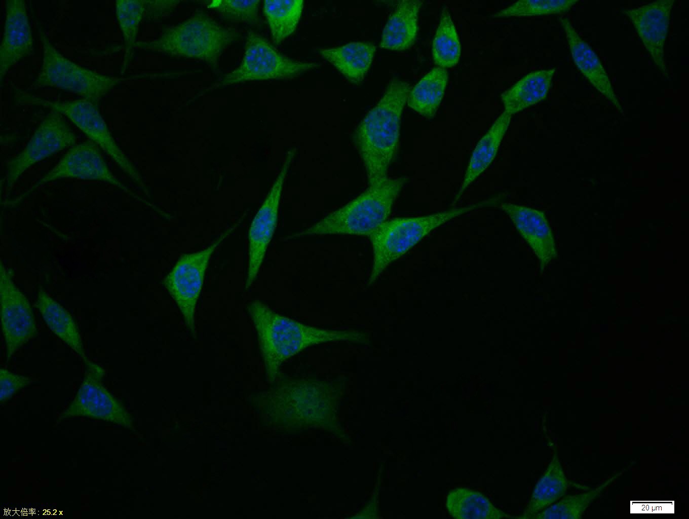 Anti-GPR30 Polyclonal Antibody