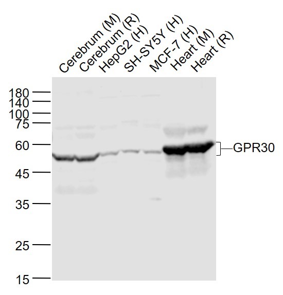 Anti-GPR30 Polyclonal Antibody 2