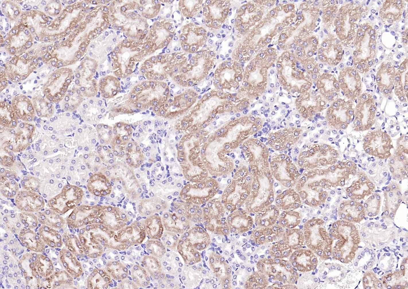 Anti-GPLD1 Polyclonal Antibody