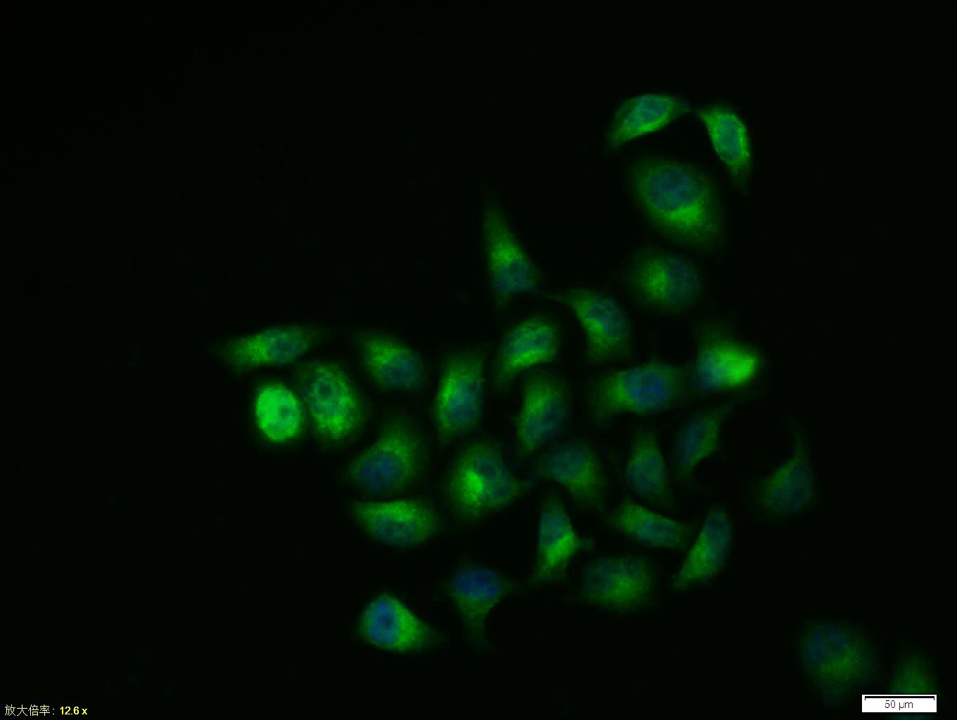 Anti-GSK3B Polyclonal Antibody 3