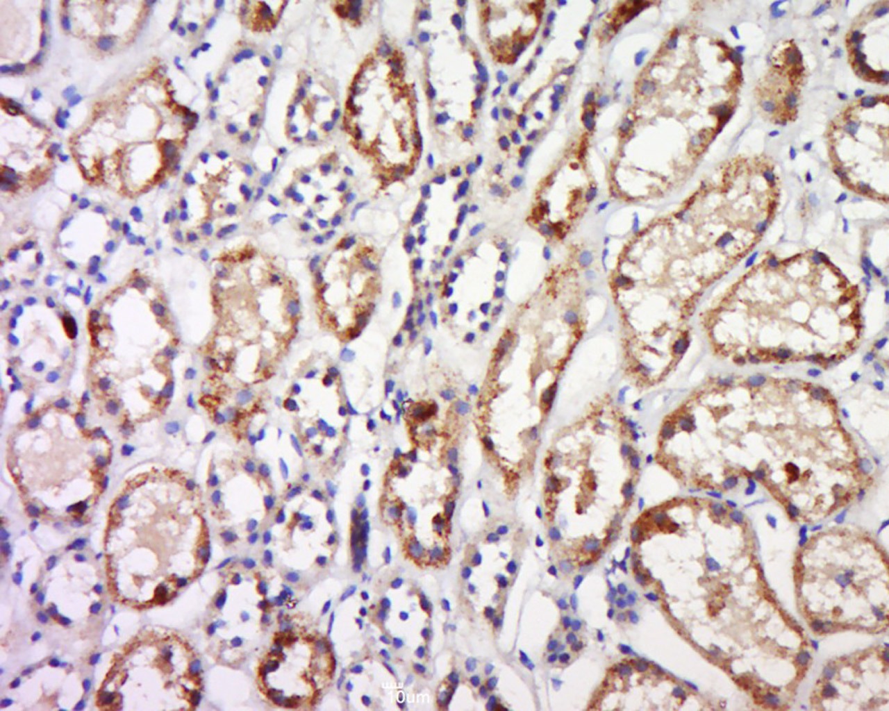 Anti-GPR91 Polyclonal Antibody