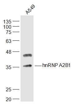 Anti-HNRNPA2B1 Polyclonal Antibody