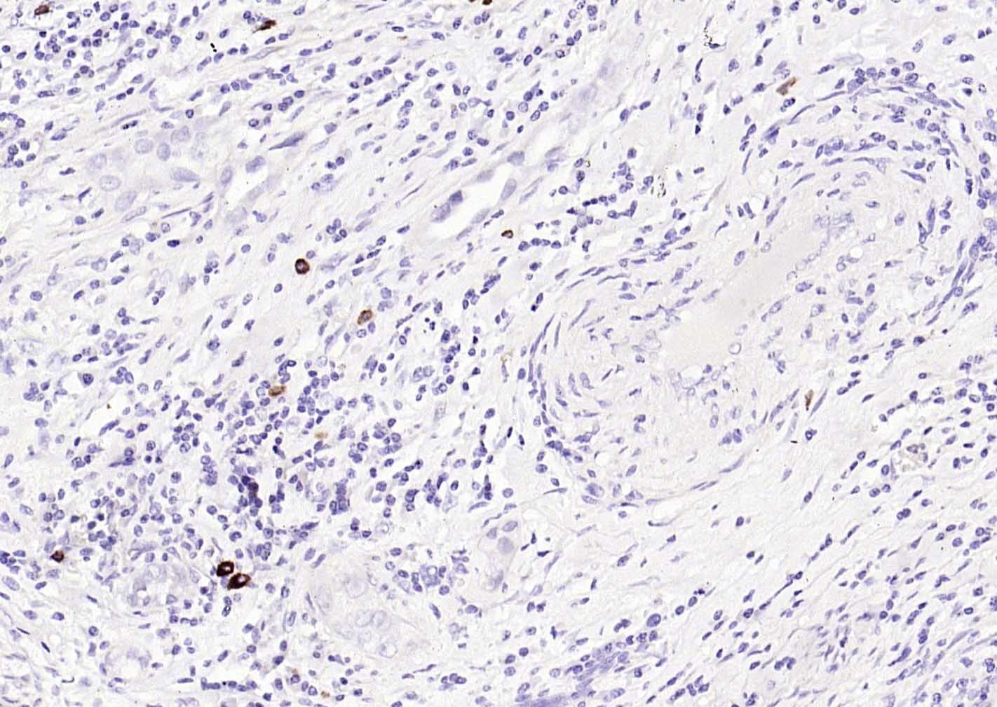Anti-HPV16 E6 Polyclonal Antibody 2