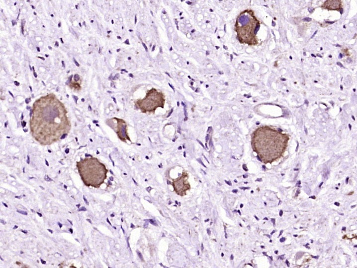 Anti-HRH1 Polyclonal Antibody