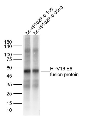 Anti-HPV16 E6 Polyclonal Antibody 2