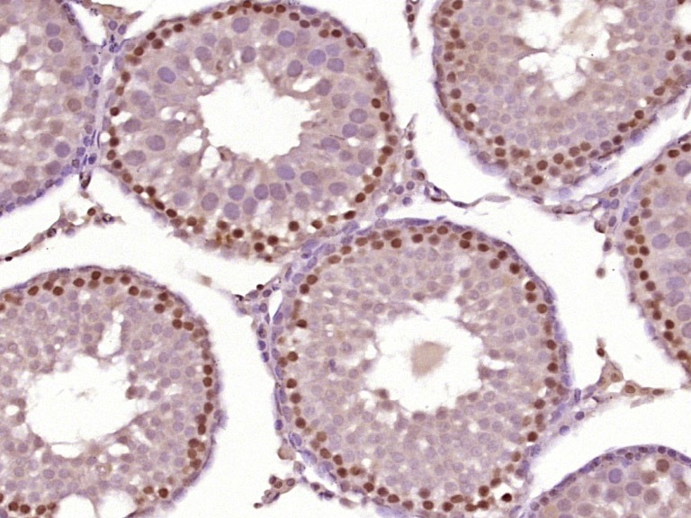 Anti-HOXA10 Polyclonal Antibody