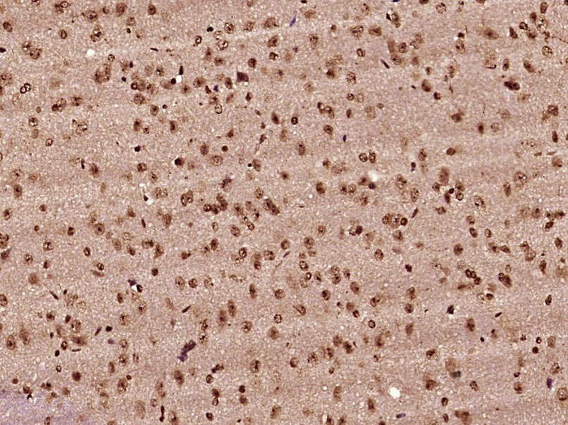 Anti-HNRNPA2B1 Polyclonal Antibody