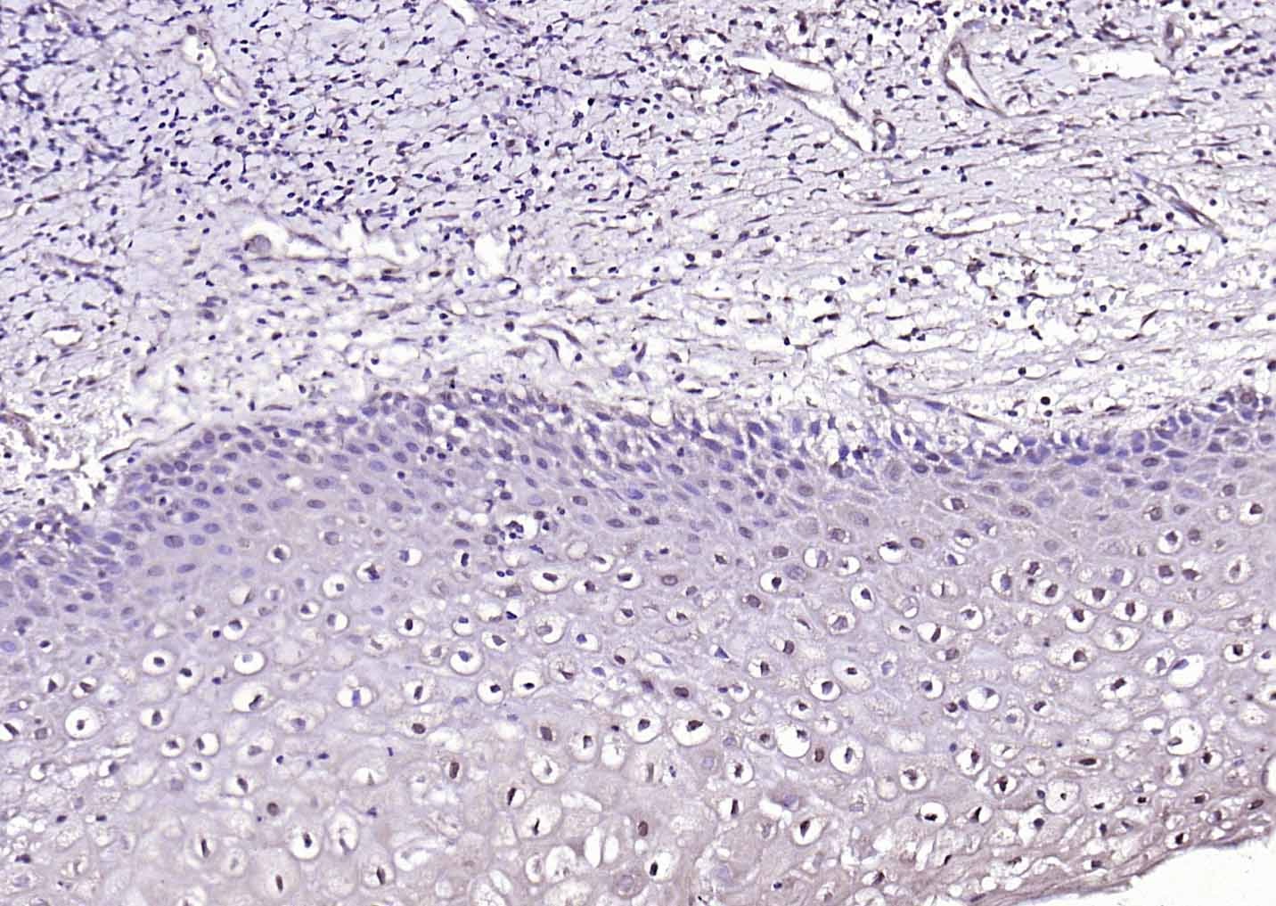 Anti-HPV16 E7 Polyclonal Antibody 3