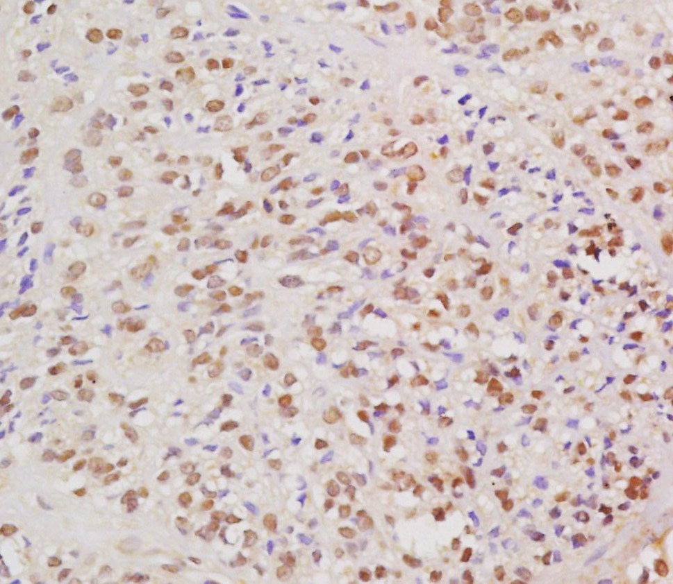 Anti-HPV16 E6 Polyclonal Antibody