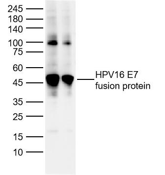Anti-HPV16 E7 Polyclonal Antibody 2