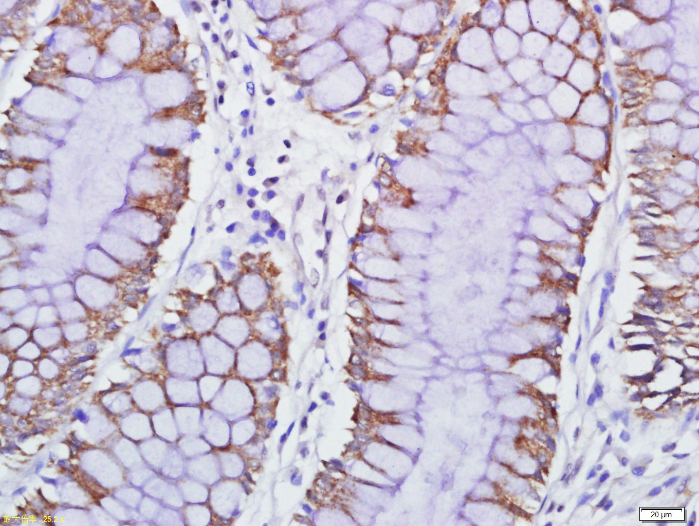 Anti-GPR84 Polyclonal Antibody 2