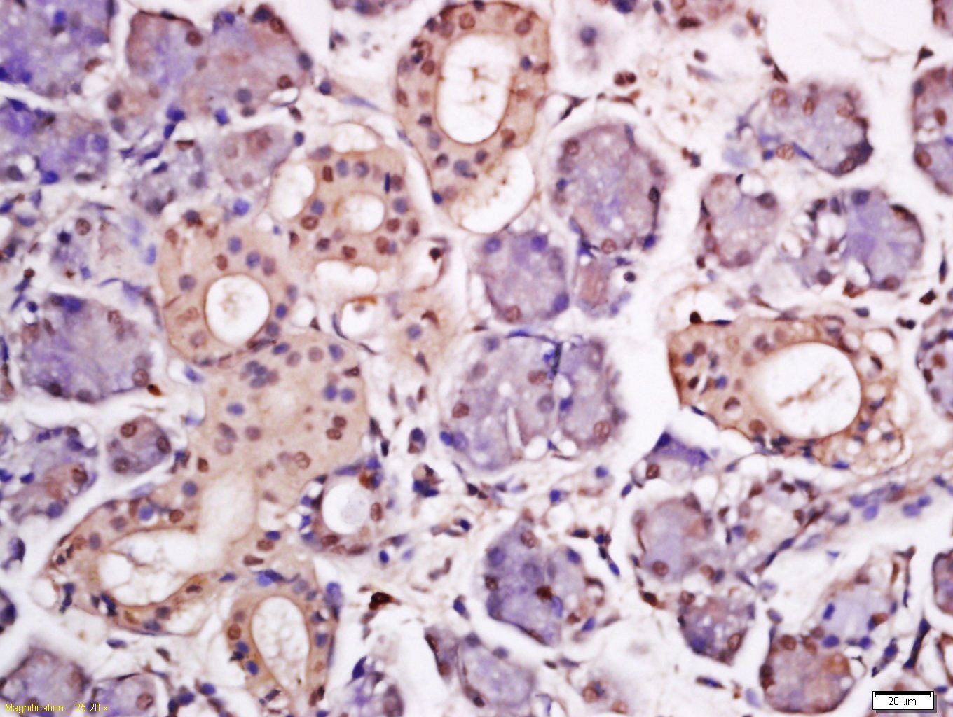 Anti-HPV16 E7 Polyclonal Antibody 3