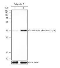 Anti-Phospho-IkB alpha/NFKBIA (Ser32, 36) Antibody (7S693)