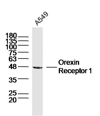 Anti-OX1R Polyclonal Antibody
