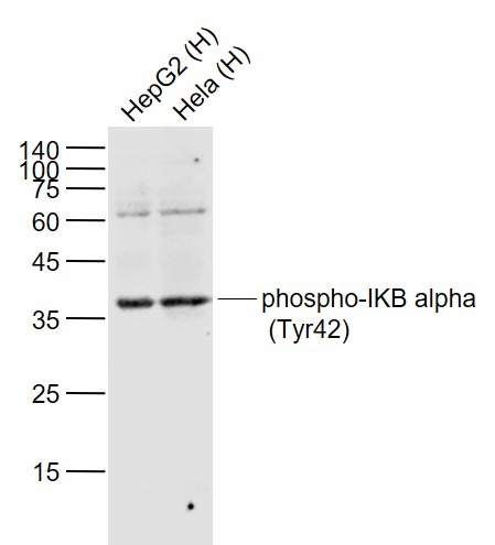 Anti-Phospho-IkB alpha/NFKBIA (Tyr42) Polyclonal Antibody