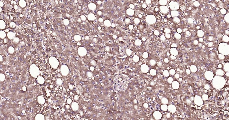 Anti-ox-LDL Antibody (4W894)