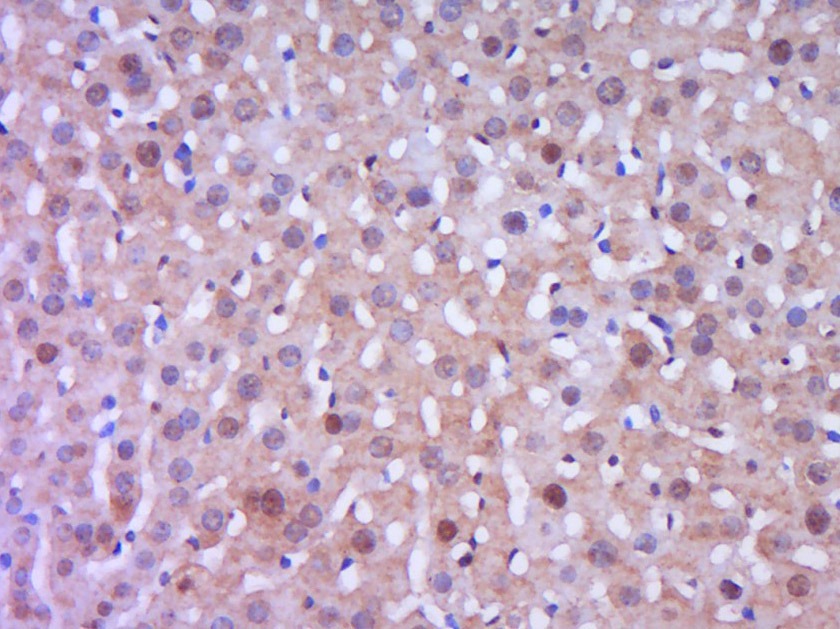 Anti-Phospho-IkB alpha/NFKBIA (Tyr305) Polyclonal Antibody