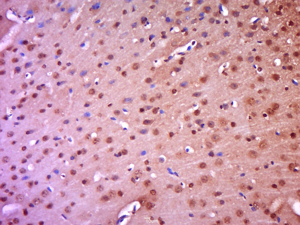 Anti-Phospho-IkB alpha/NFKBIA (Tyr305) Polyclonal Antibody