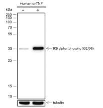 Anti-Phospho-IkB alpha/NFKBIA (Ser32, 36) Antibody (7S693)